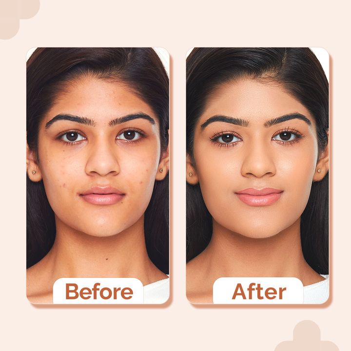 The Derma Co.