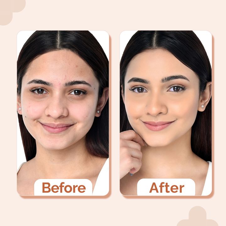 The Derma Co.