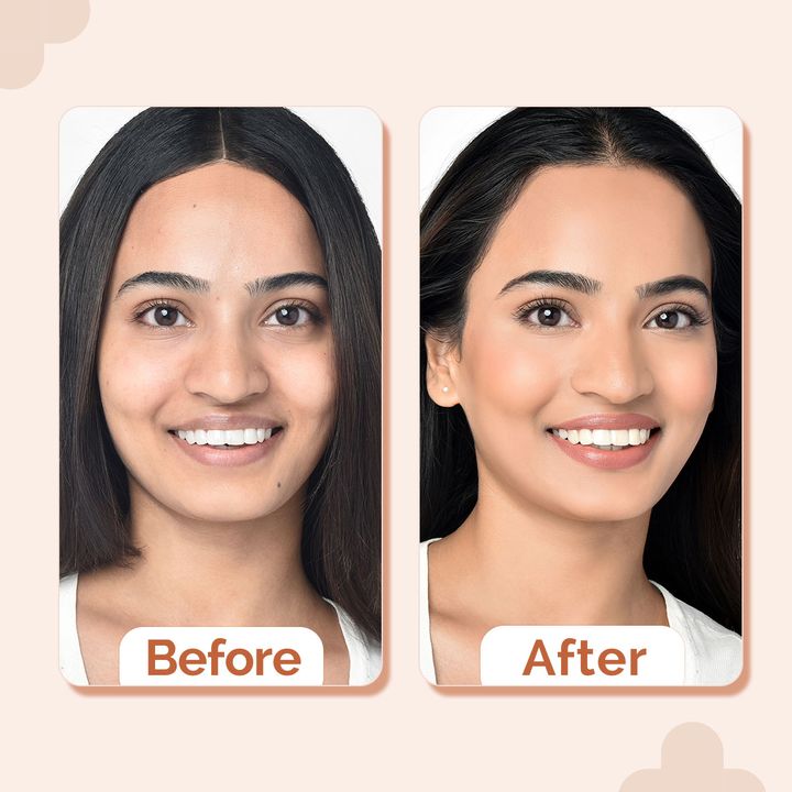The Derma Co.