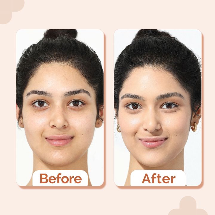 The Derma Co.