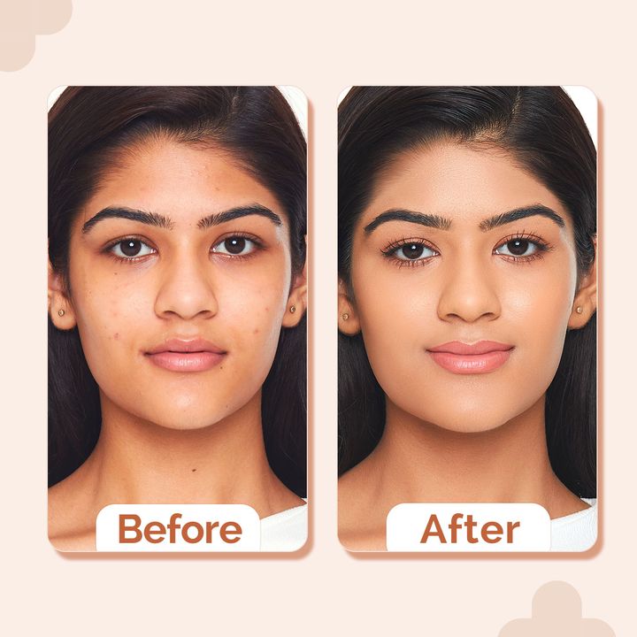The Derma Co.