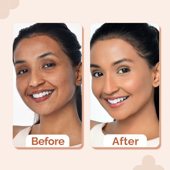 The Derma Co.